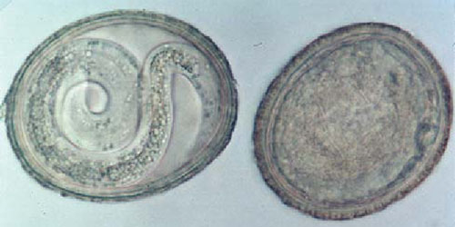two intestinal parasites