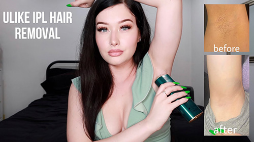 lady using portable laser hair removal device