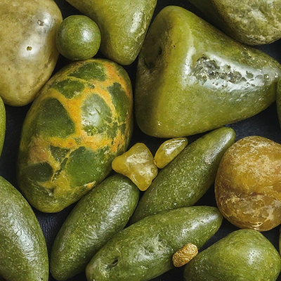 gallstones of all varieties and sizes